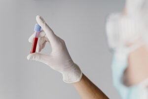 Blutprobe zur Untersuchung im Labor